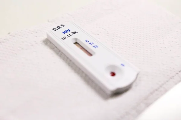 Nos últimos seis anos, HIV na população idosa do DF cresceu 275%