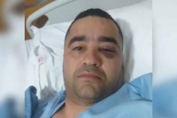 Paulo Vitor Araujo- Passageiro agredido em metrô no Rio 1