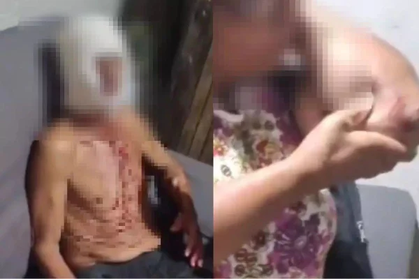 O autor do crime fugiu e está desaparecido. Ele golpeou o sogro e deixou a sogra ferida. O caso aconteceu em Registro, interior de São Paulo - Metrópoles