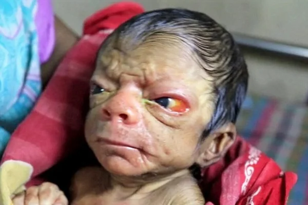 Garoto que estava em coma acorda para dizer que ama a família e morre