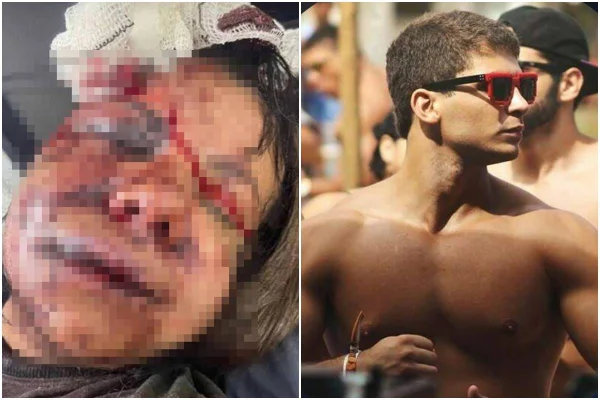 Mulher ficou totalmente desfigurada após ser agredida brutalmente por ex dentro de elevador em Natal - Metrópoles