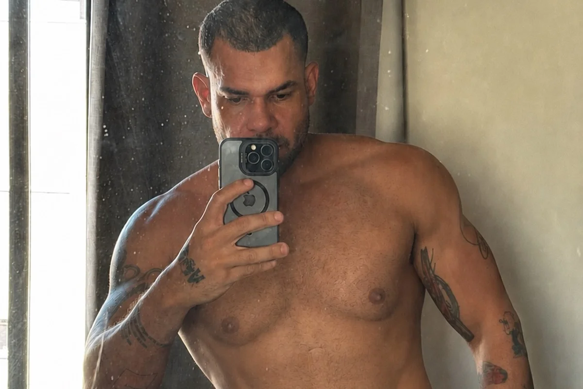 Diego Menasse fez um procedimento para remover excesso de pele após uma bariátrica Diego Menasse fez um procedimento para remover excesso de pele após uma bariátrica