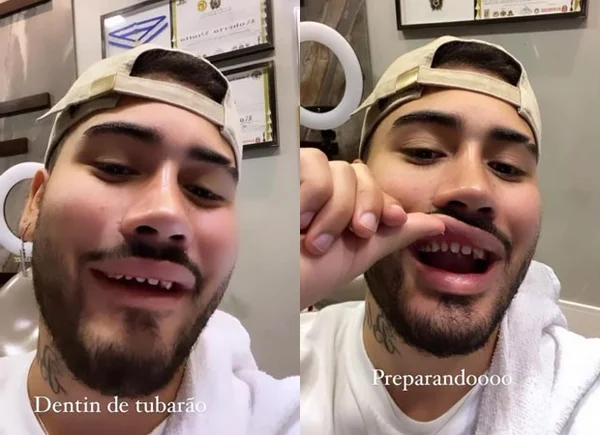 Kevinho sem lentes de contato nos dentes