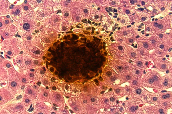 Foto microscópica de ilhotas cheias de insulina - Metrópoles