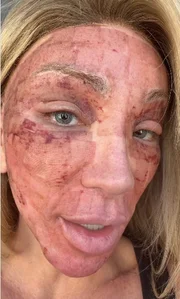 Maya Massafera detalhou o tratamento que fez para o rosto Maya Massafera detalhou o tratamento que fez para o rosto