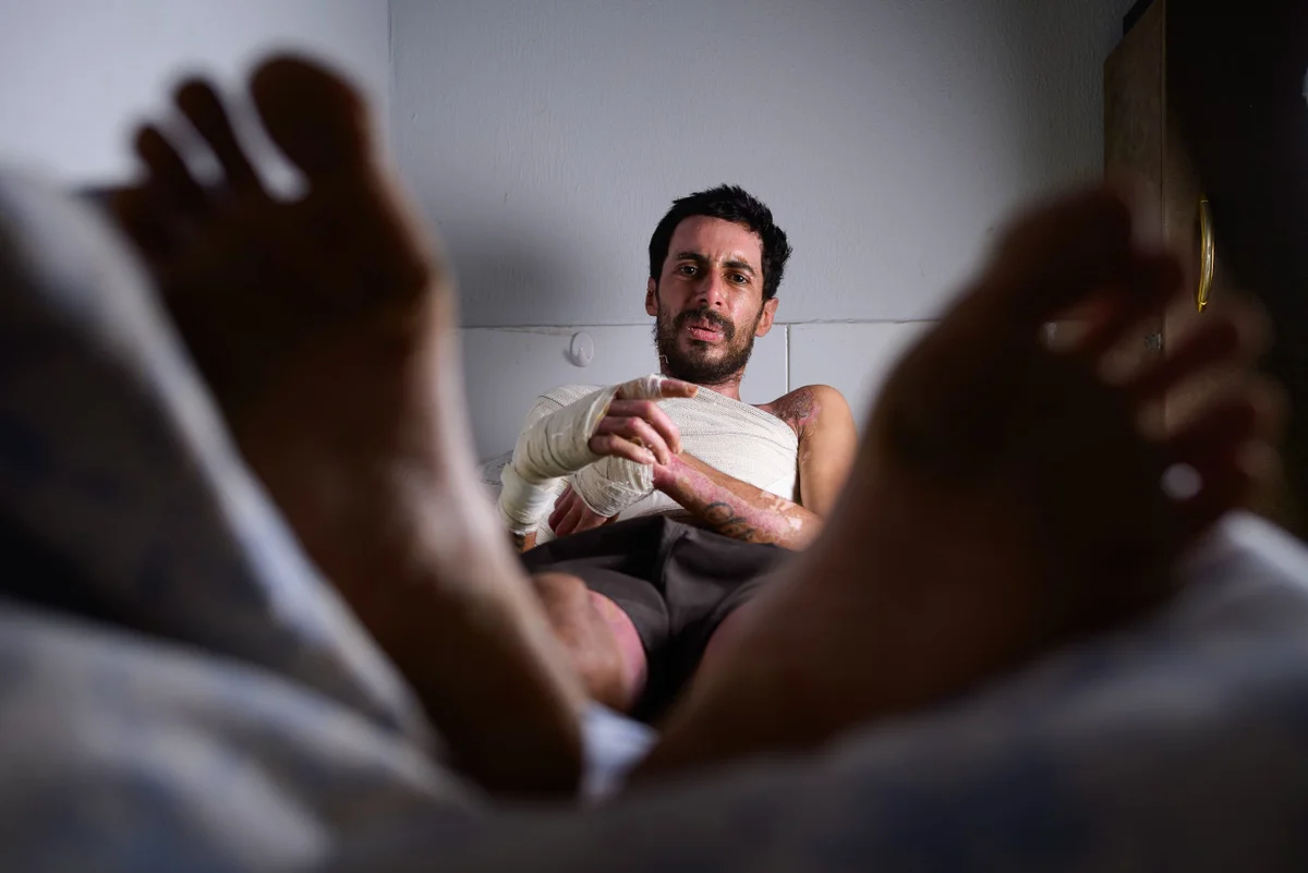 Gustavo relata dificuldades para retomar a rotina após o ataque. Sem poder trabalhar, ele afirma gastar mais de R$ 1,2 mil por mês com pomadas, medicamentos, curativos e transporte Gustavo relata dificuldades para retomar a rotina após o ataque. Sem poder trabalhar, ele afirma gastar mais de R$ 1,2 mil por mês com pomadas, medicamentos, curativos e transporte