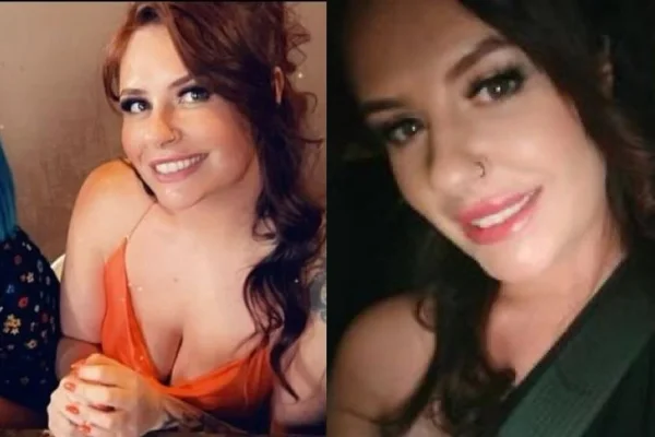 Mulher ganha cicatrizes iguais a tiros após preenchimento nos glúteos