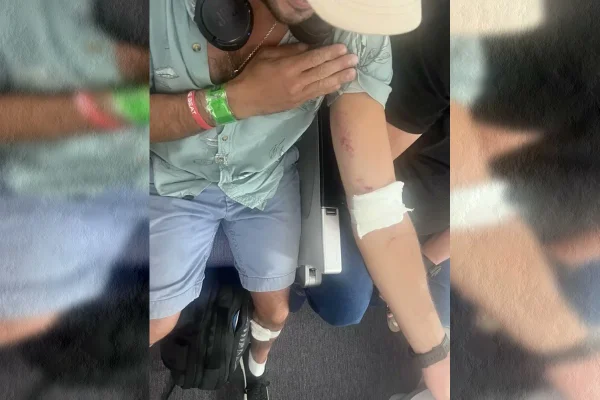 “Passageiros batiam no teto”, diz testemunha de voo com 50 feridos