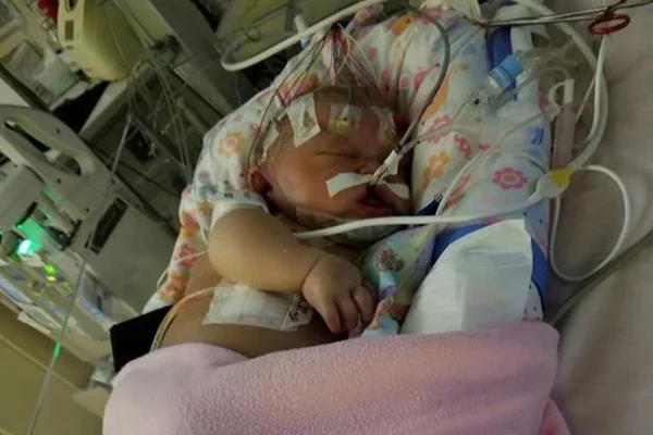 Recém-nascida morre após receber beijo de alguém com herpes