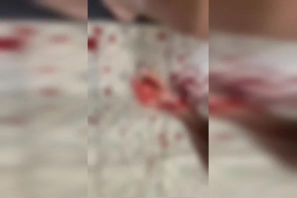 Homem tenta invadir hospital e matar esposa esfaqueada diante da filha