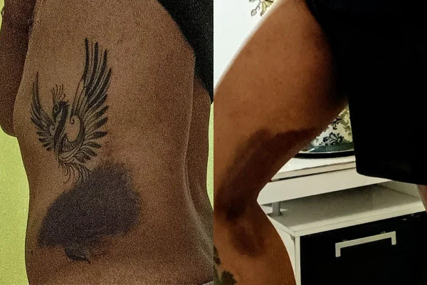 O cantor foi agredido com cabos de vassoura por 7 familiares. Além de homofobia, o homem alega intolerância religiosa dos parentes - Metrópoles