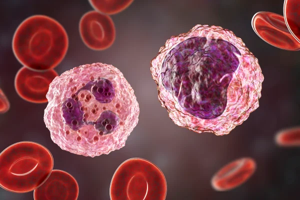 Céulas do sangue câncer