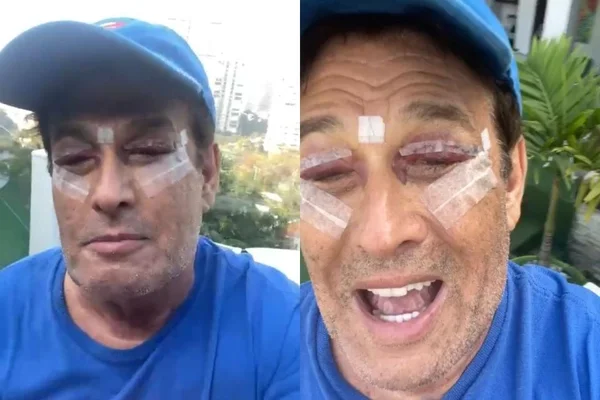 Sérgio Mallandro reaparece após cirurgia nos olhos
