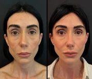 A jornalista Michelle Barros, de 46 anos A jornalista Michelle Barros, de 46 anos