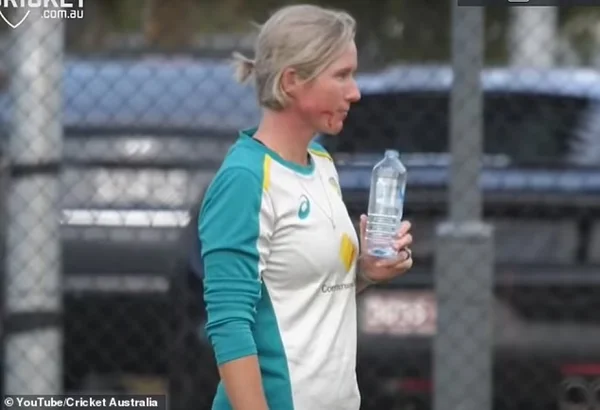 Beth Mooney após cirurgia por ter mandíbula quebrada