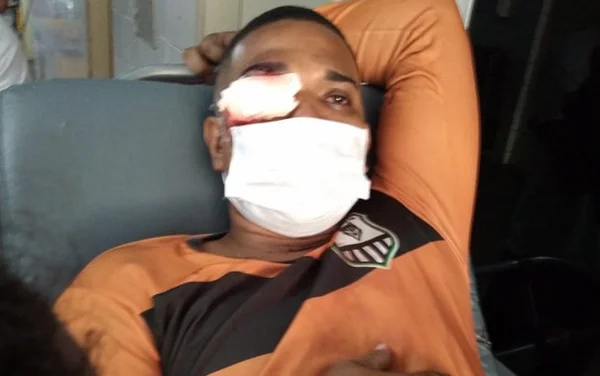 PM que cegou homem com bala de borracha no Recife é afastado