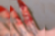 Lesão no dedo da influenciadora